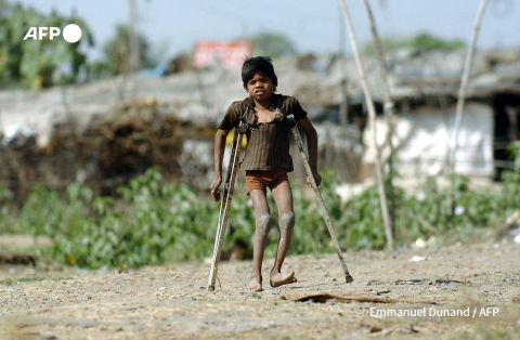 Jeune handicapé à Bhophal, le 2 décembre 2004 - Emmanuel Dunand - AFP