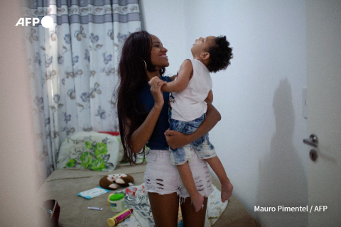 Miguel, the first child in Brazil to be diagnosed with Zika - Mauro Pimentel - AFP